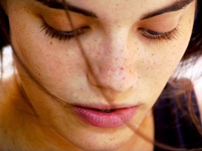 Best tips to get rid of freckles